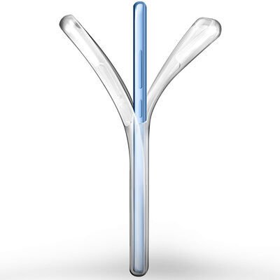 Xiaomi Mi Note 10 Lite Kılıf Patinda Enjoy Kapak