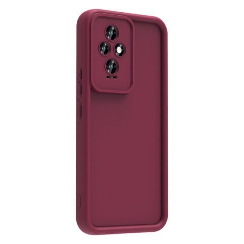 Honor 200 Kılıf Kamera Korumalı Patinda Ananas Kapak