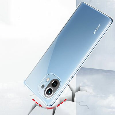 Xiaomi Mi 11 Lite Kılıf Patinda Süper Silikon Kapak