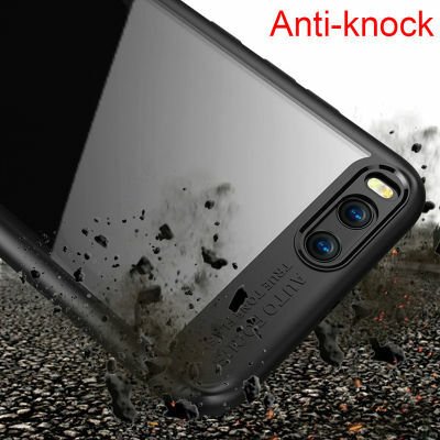 Xiaomi Mi 6 Kılıf Patinda Buttom Kapak