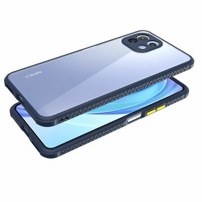 Xiaomi Mi 11 Lite Kılıf Patinda Kaff Kapak