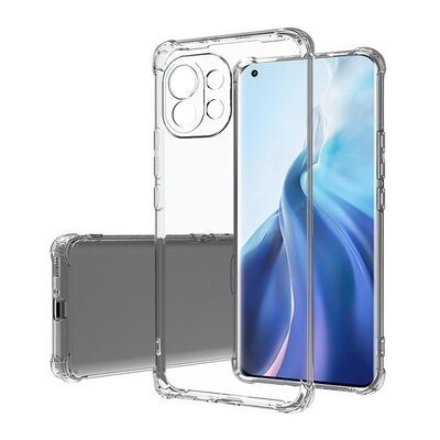 Xiaomi Mi 11 Lite Kılıf Patinda Kamera Korumalı Nitro Anti Shock Silikon
