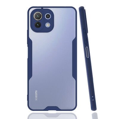 Xiaomi Mi 11 Lite Kılıf Patinda Parfe Kapak