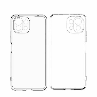 Xiaomi Mi 11 Kılıf Patinda Kamera Korumalı Süper Silikon Kapak