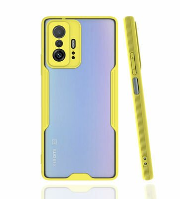 Xiaomi Mi 11T Pro 5G Kılıf Patinda Parfe Kapak