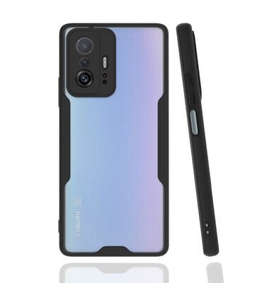 Xiaomi Mi 11T 5G Kılıf Patinda Parfe Kapak