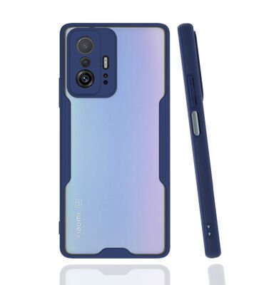 Xiaomi Mi 11T 5G Kılıf Patinda Parfe Kapak
