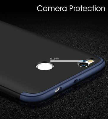 Xiaomi Redmi 4x Kılıf Patinda Ays Kapak