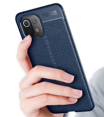 Xiaomi Mi 11 Lite Kılıf Patinda Niss Silikon Kapak