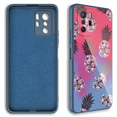 Xiaomi Redmi Note 10 Pro Kılıf Kamera Korumalı Desenli Sert Silikon Patinda Epoksi Kapak