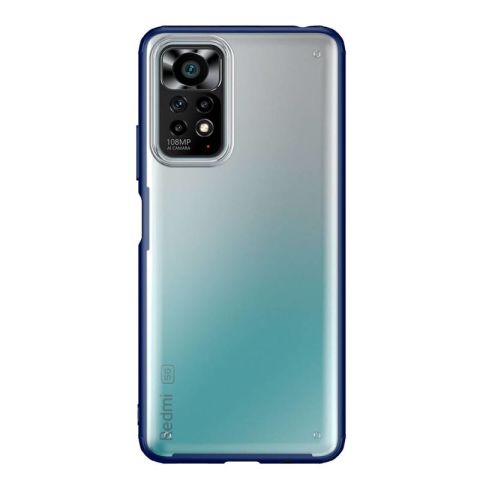Xiaomi Redmi Note 11S Global Kılıf Patinda Volks Kapak